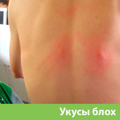 Укусы блох в Мариинске