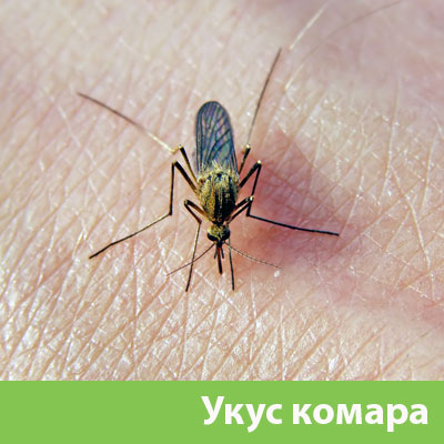 Укусы комаров в Мариинске